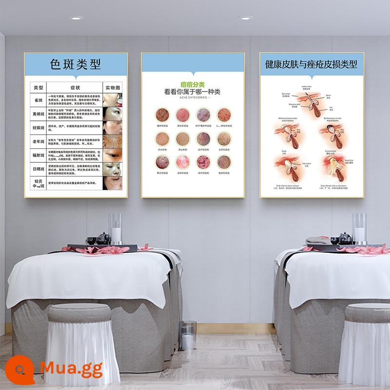 Hình ảnh in poster xóa tàn nhang trị mụn - Các loại vết bẩn (3 ảnh đang bán) 3