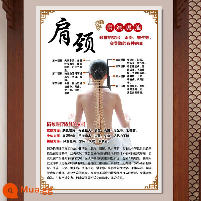 Moxibustion, xoa bóp, giác hơi, cạo, xoa bóp, áp phích vật lý trị liệu, bản đồ công khai cửa hàng xoa bóp, trung tâm y tế y học cổ truyền Trung Quốc, tranh treo trang trí - 28-Chăm sóc vai và cổ