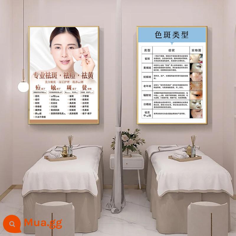 Hình ảnh in poster xóa tàn nhang trị mụn - Xóa tàn nhang (gói giảm giá 2 tờ) 3