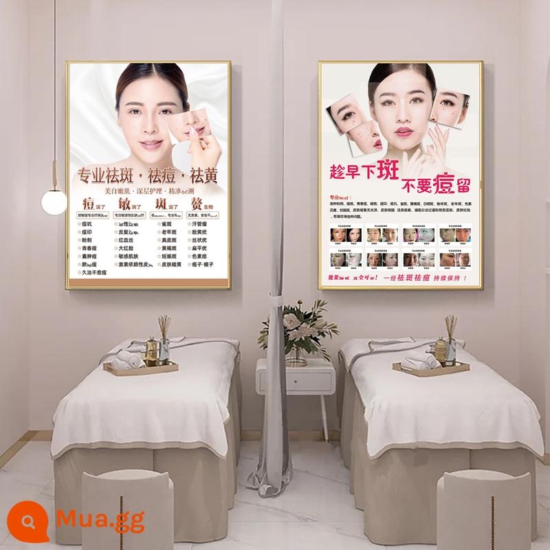 Hình ảnh in poster xóa tàn nhang trị mụn - Xóa tàn nhang (gói giảm giá 2 tờ) 2