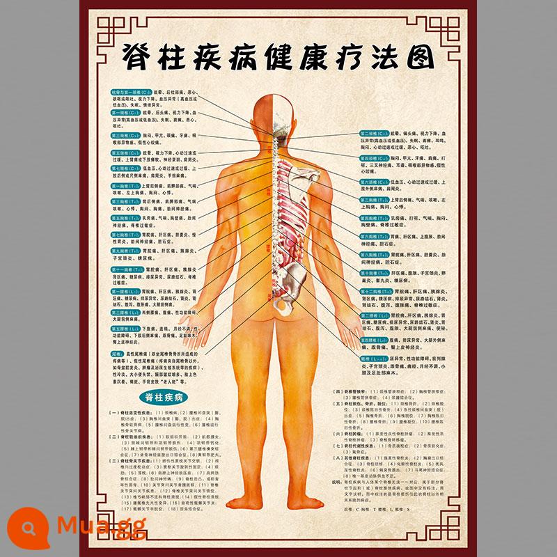 Hình ảnh cột sống cổ vai viêm quanh khớp poster thoái hóa đốt sống cổ cột sống thắt lưng bản đồ tăng sản xương sticker dán tường gói phong phú poster tuyên truyền - Sơ đồ sức khỏe bệnh cột sống Liaofa 626