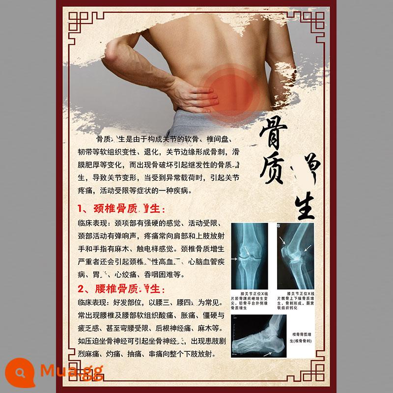 Hình ảnh cột sống cổ vai viêm quanh khớp poster thoái hóa đốt sống cổ cột sống thắt lưng bản đồ tăng sản xương sticker dán tường gói phong phú poster tuyên truyền - tăng sản xương