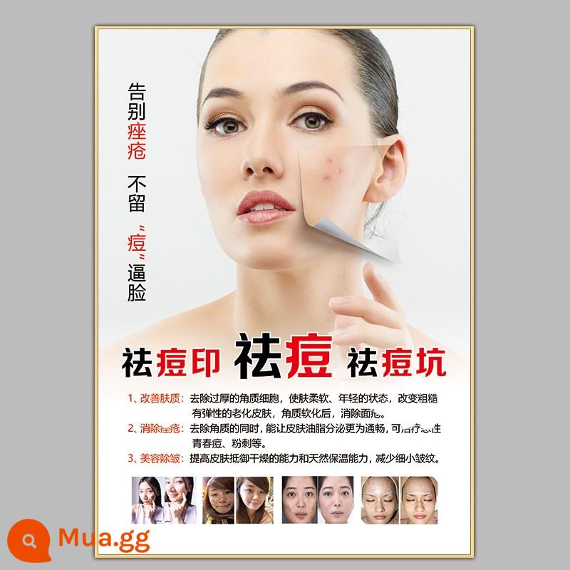 Hình ảnh in poster xóa tàn nhang trị mụn - 10. Loại bỏ tàn nhang, loại bỏ mụn trứng cá và loại bỏ vết mụn.