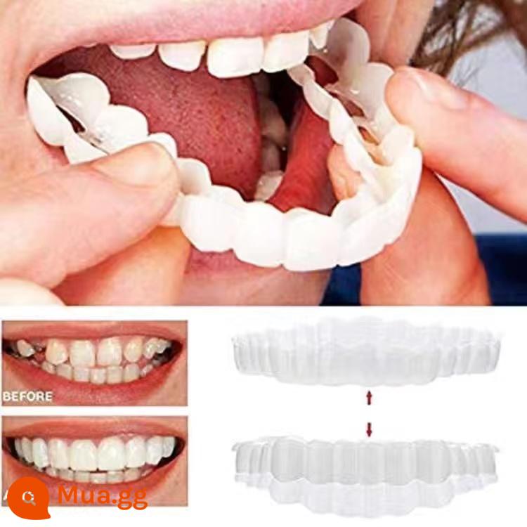 Răng khoảng cách lớn răng giả niềng răng mô phỏng răng giả khoảng cách lấp đầy tạo tác răng phía trước khoảng cách Corrector lớn buck răng niềng răng - Niềng răng + hộp nha khoa