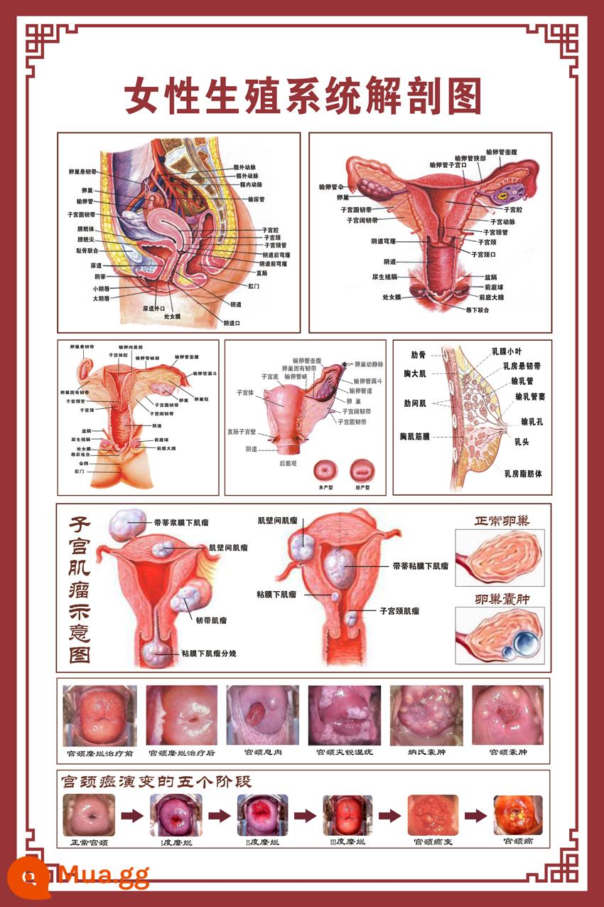 Sơ đồ giải phẫu hệ thống sinh dục nữ sơ đồ bệnh viện áp phích treo tường tử cung áp phích phụ khoa sơ đồ bệnh cổ tử cung - giải phẫu hệ sinh sản nữ