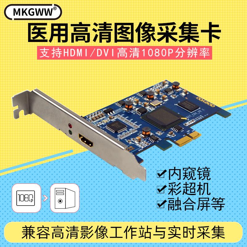 Thẻ quay video hdmi độ nét cao 1080P tích hợp thẻ y tế hội nghị hình ảnh chụp siêu âm màu video tín hiệu dvi