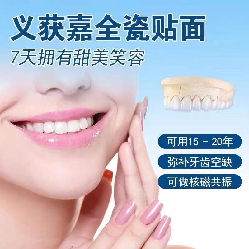 Mặt dán toàn sứ Ivoca, mặt dán sứ siêu mỏng, sứ xanh nhập khẩu, sứ Lingxi, tẩy trắng răng, răng sứ, tùy chỉnh riêng