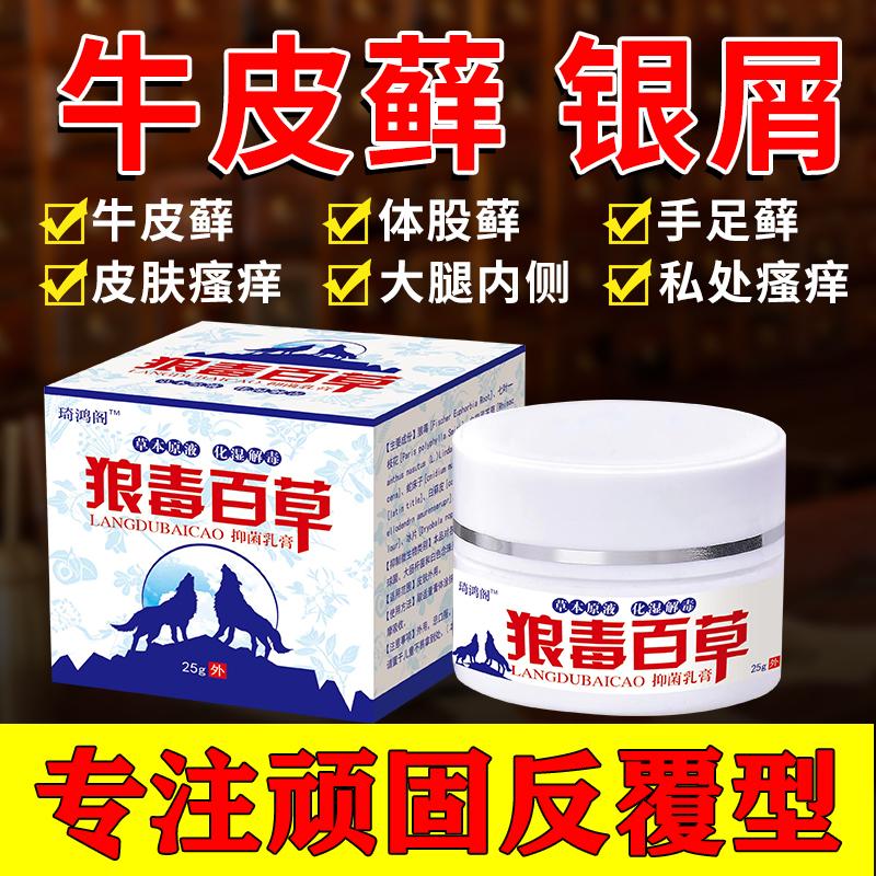 Trị vảy nến, vảy nến, eczema, trị ngứa và tận gốc, đặc trị da đầu, tay, chân, nấm da, rêu, bệnh ngoài da, thuốc bôi ngoài