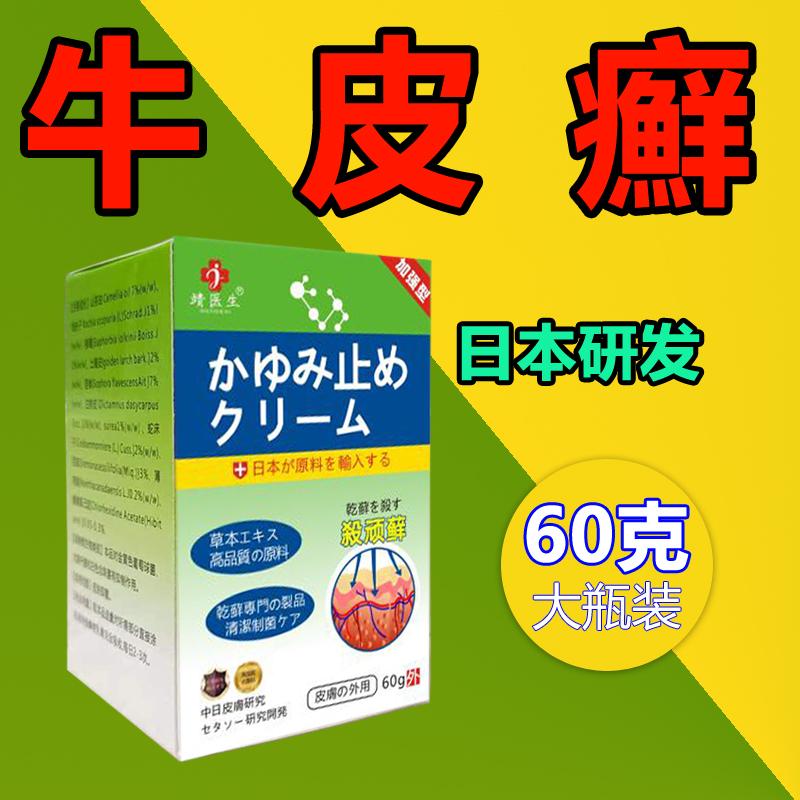 Bệnh vẩy nến vẩy nến công thức Nhật Bản, bệnh chàm, bệnh da, tinea -and -tiner, itip ngứa, rễ, chân và chân rêu