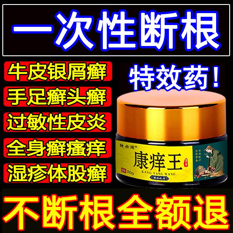 Kangching King Eczema chống rhizoplasty da poethamis da da ngứa, chống vi khuẩn chống nhiễm trùng, toàn thân ngứa sử dụng bên ngoài