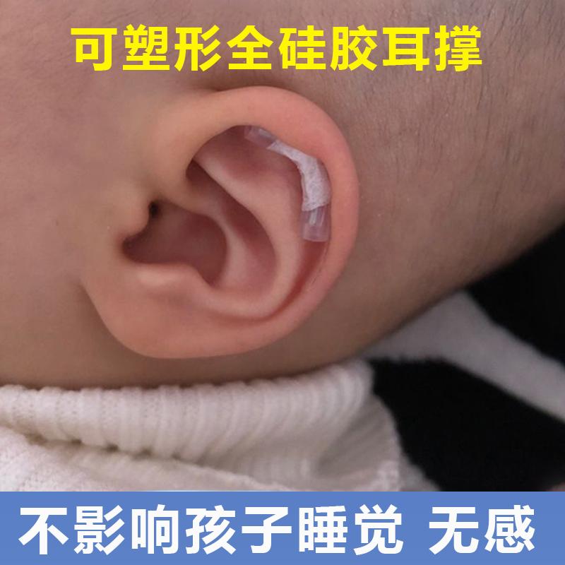 Dụng cụ chỉnh sửa tai cho bé sơ sinh auricle chỉnh hình miếng dán định hình đúng hình máy kéo dái tai ngoài cho bé