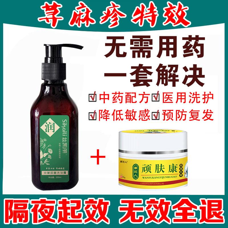 Choline sẩn mề đay sữa tắm tác dụng đặc biệt giảm ngứa kháng khuẩn toàn thân ngứa dị ứng mề đay đặc trị